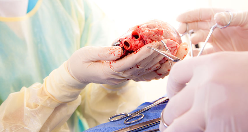 organ transplant Predictions