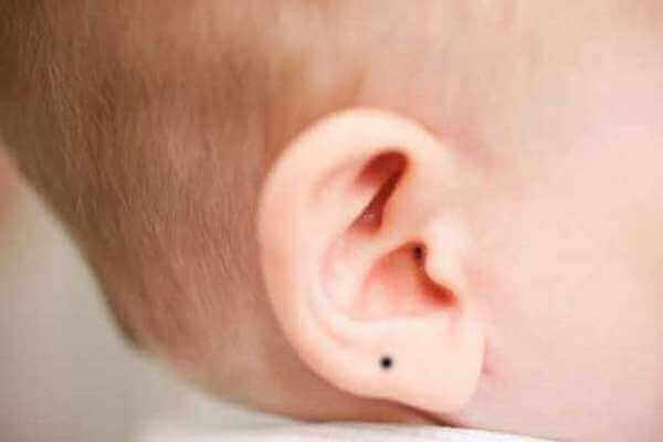 Ear Mole Astrology