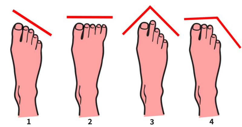 types of toes