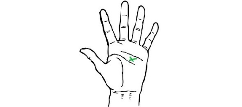 Do you have the letter X Sign on palm? Know its meaning